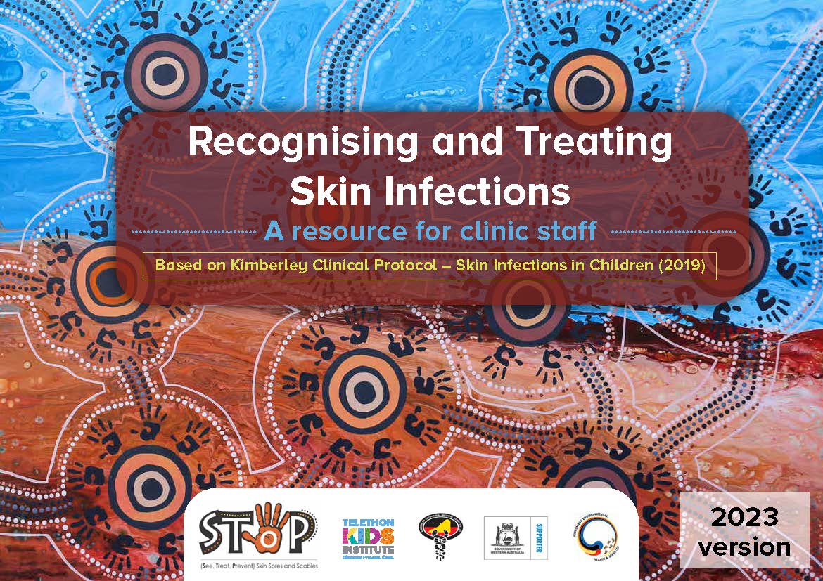 Recognising and treating skin infections: a resource for clinic staff